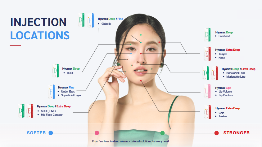 Hyamax injection locations diagram